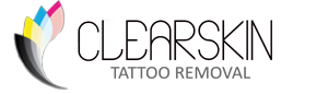 Remoción de tatuajes en
                  Toluca - CLEARSKIN